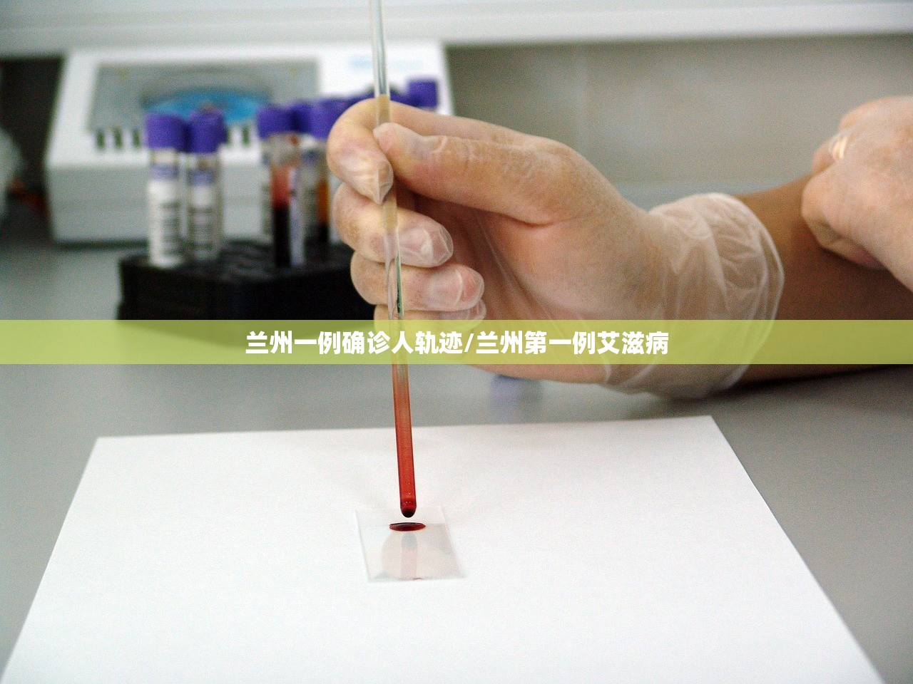 兰州一例确诊人轨迹/兰州第一例艾滋病 兰州一例确诊人轨迹/兰州第一例艾滋病