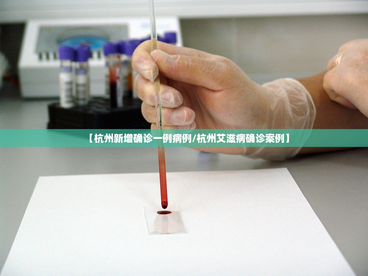 【杭州新增确诊一例病例/杭州艾滋病确诊案例】 【杭州新增确诊一例病例/杭州艾滋病确诊案例】