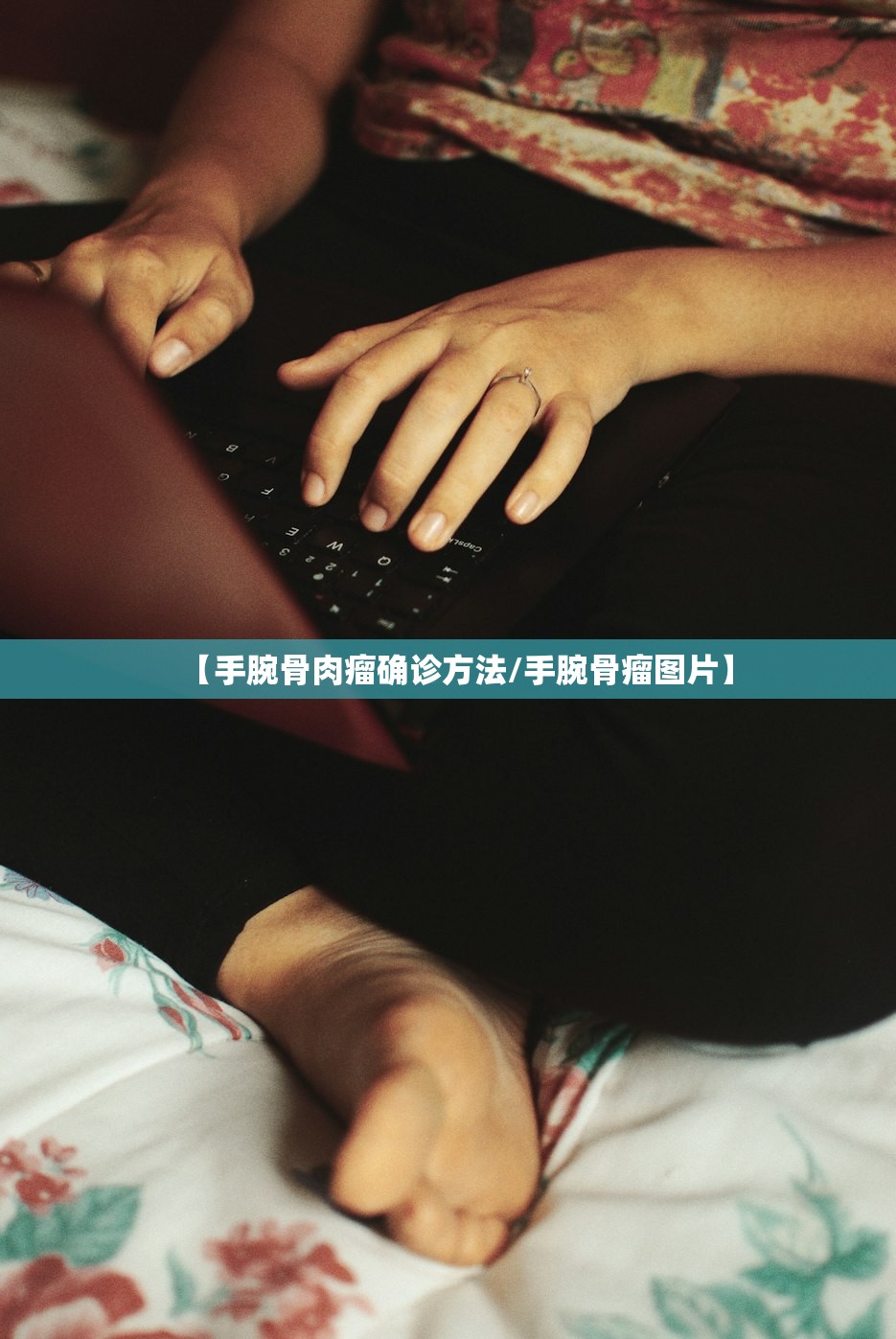 【手腕骨肉瘤确诊方法/手腕骨瘤图片】 【手腕骨肉瘤确诊方法/手腕骨瘤图片】